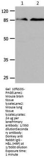 CTNNB1 Antibody