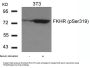 Phospho-FOXO1 (Ser319) Antibody