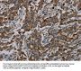 CFLAR Antibody