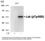 Phospho-LCK (Tyr505) Antibody