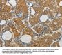 MAP4K5 Antibody