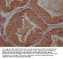 PCDHB7 Antibody
