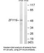 ZFYVE19 Antibody