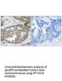 ZFYVE19 Antibody