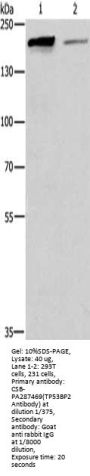 TP53BP2 Antibody