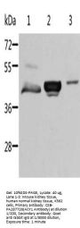 ACY1 Antibody