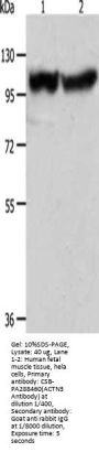 ACTN3 Antibody