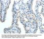 TRIB1 Antibody