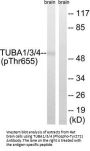Phospho-TUBA1A/TUBA1B/TUBA1C/TUBA3C/TUBA3E/TUBA4A (Tyr272) Antibody