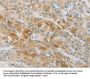 ACSL4 Antibody
