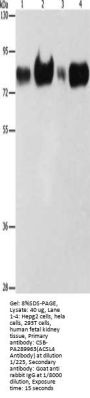 ACSL4 Antibody
