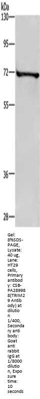 TRIM29 Antibody