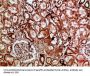 IMP3 Antibody