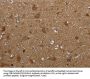 PPP1R13L Antibody