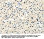 VIPR1 Antibody