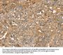 ROBO3 Antibody
