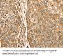 ROBO3 Antibody