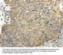 PKM Antibody