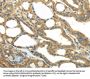 PKM Antibody