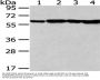 PKM Antibody