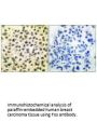FOS Antibody