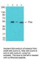 FOS Antibody