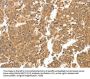 Rabbit anti-human LYZ polyclonal antibody