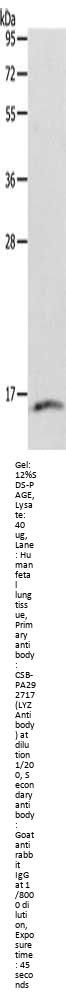 Rabbit anti-human LYZ polyclonal antibody