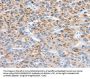 CCS Antibody