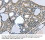 CCS Antibody