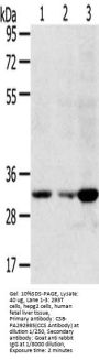 CCS Antibody