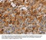 CCR9 Antibody