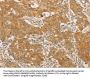SNAP91 Antibody