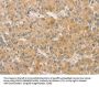 SNAP91 Antibody
