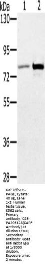 CARF Antibody