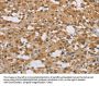 DDX43 Antibody