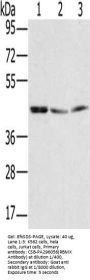 RBMX Antibody