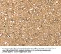 SDC3 Antibody
