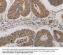 CDKN1A Antibody