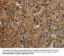 HSD17B14 Antibody