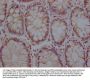 ZP2 Antibody