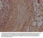 ZP2 Antibody