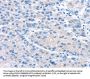 UCP2 Antibody