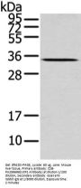 UCP2 Antibody
