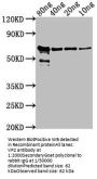 VP2 Antibody