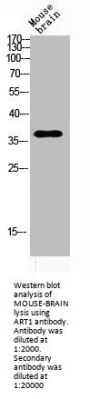 ART1 Antibody