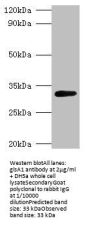 Rabbit anti-Escherichia coli Glutaminase 1 polyclonal Antibody