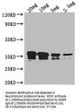 RCSF Antibody