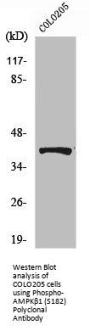 Phospho-PRKAB1 (S182) Antibody