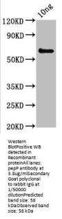 pepP Antibody